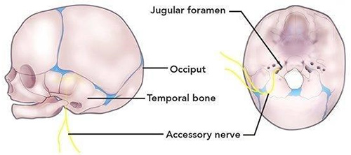Torticollis Osteopathic Healing Hands